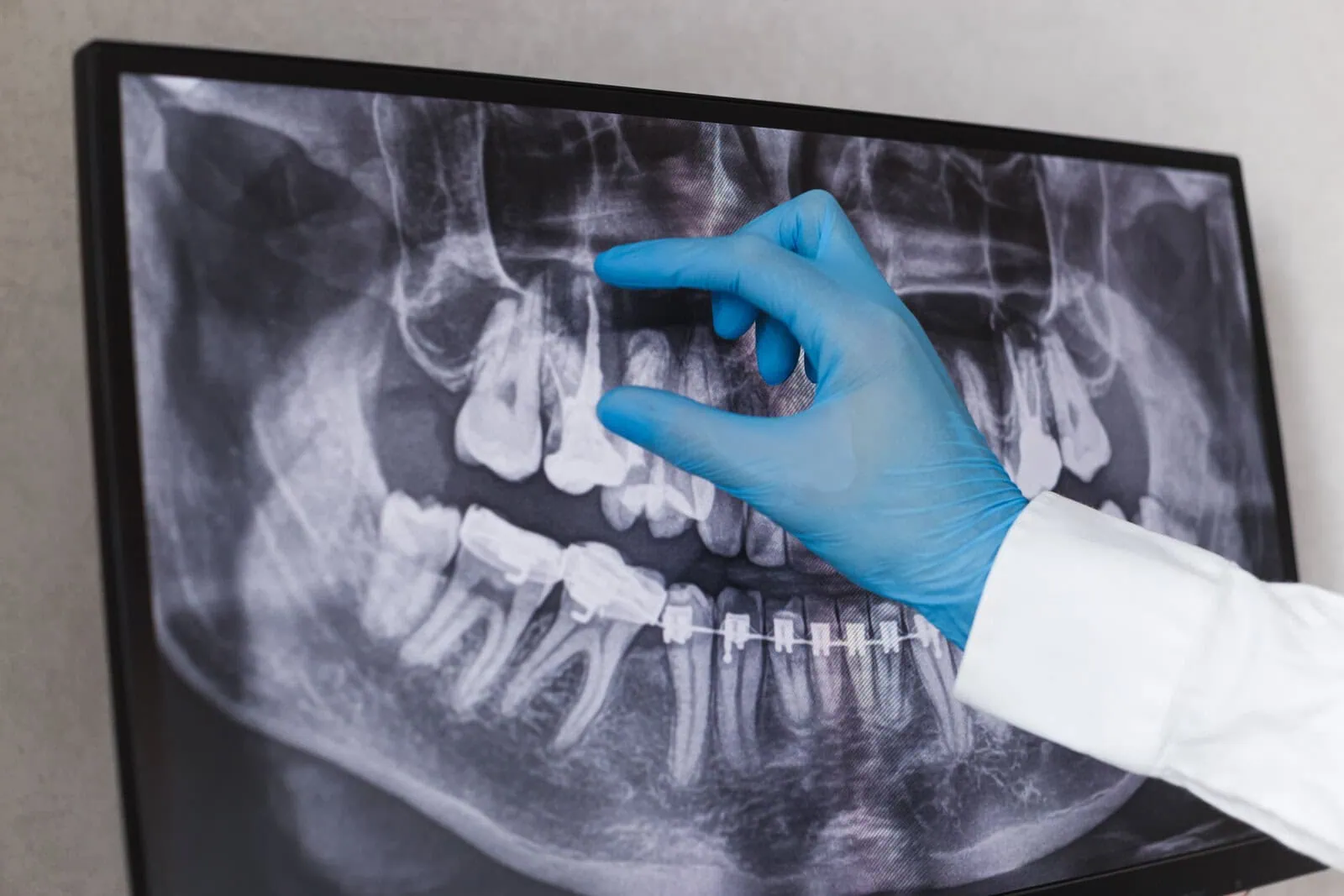 Advanced dental technology at Riverwalk Dental Group