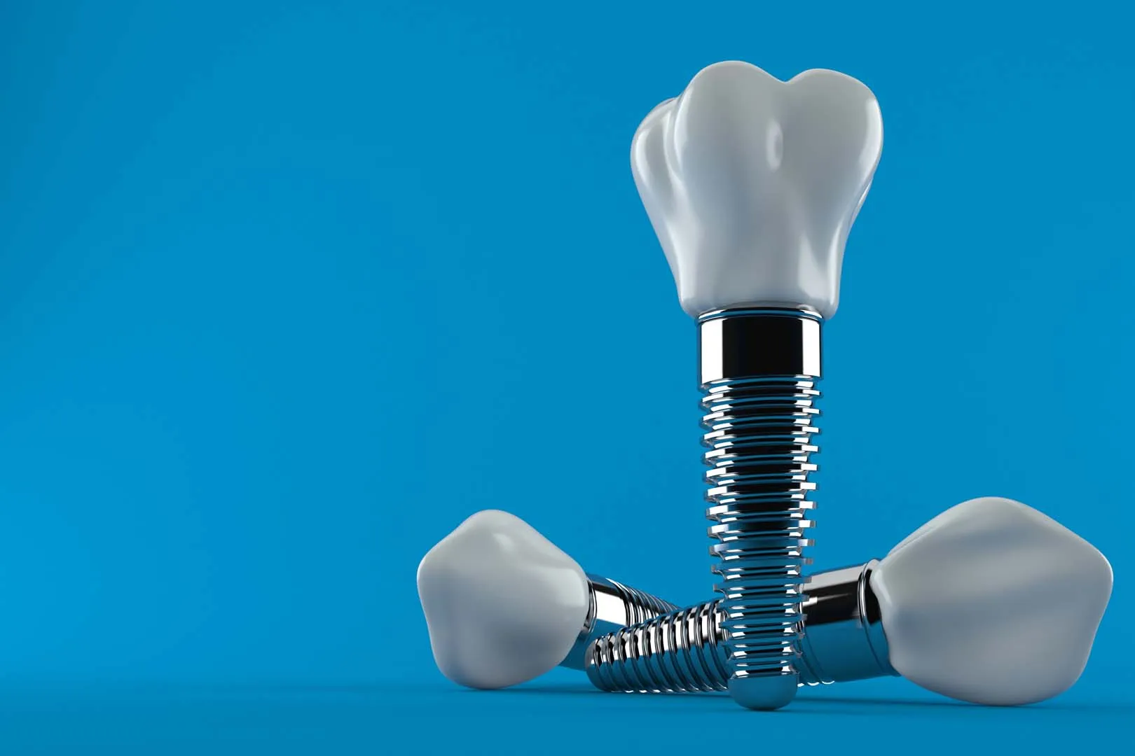 Dental implant placement at Riverwalk Dental Group