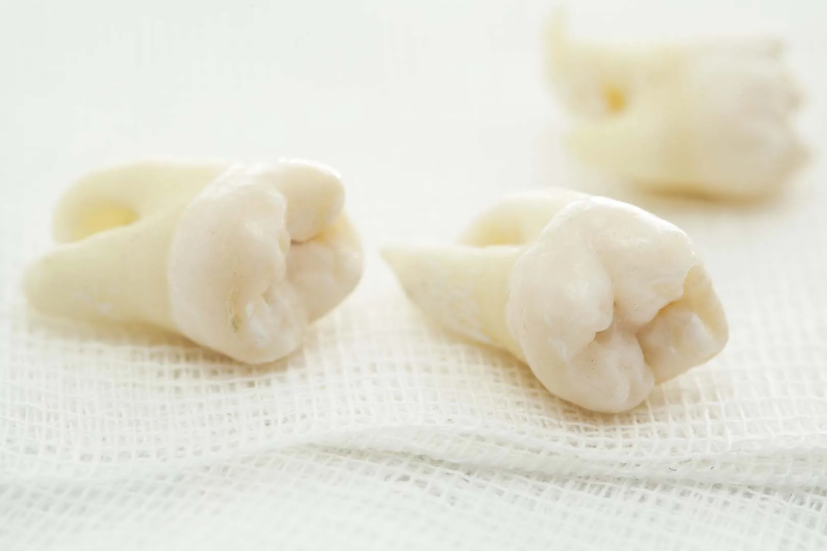 Wisdom tooth extraction at Riverwalk Dental Group
